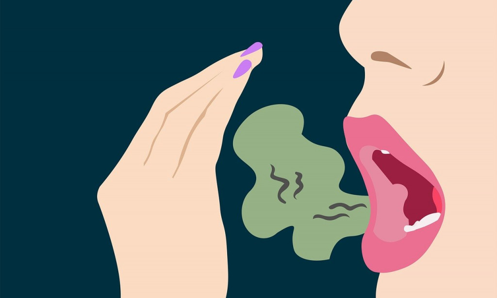 Top 10 Home Remedies To Get Rid Of Bad Breath